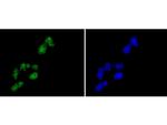 Histone H2A.Z Recombinant Rabbit Monoclonal Antibody (ST46-09)