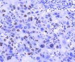 Histone H2A.Z Antibody in Immunohistochemistry (Paraffin) (IHC (P))