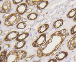 HK1 Antibody in Immunohistochemistry (Paraffin) (IHC (P))