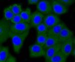 DNMT3A Antibody in Immunocytochemistry (ICC/IF)