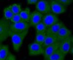 DNMT3A Antibody in Immunocytochemistry (ICC/IF)