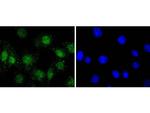 Phospho-AKT1 (Ser124) Antibody in Immunocytochemistry (ICC/IF)