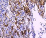 Phospho-AKT1 (Ser124) Antibody in Immunohistochemistry (Paraffin) (IHC (P))