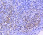 ICAM-1 Antibody in Immunohistochemistry (Paraffin) (IHC (P))