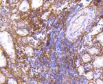 ICAM-1 Antibody in Immunohistochemistry (Paraffin) (IHC (P))