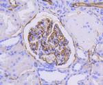ICAM-1 Antibody in Immunohistochemistry (Paraffin) (IHC (P))