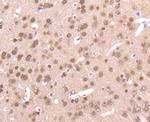 AKT Pan Antibody in Immunohistochemistry (Paraffin) (IHC (P))