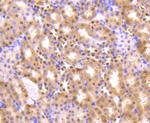 AKT Pan Antibody in Immunohistochemistry (Paraffin) (IHC (P))