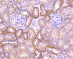 Pan-cadherin Antibody in Immunohistochemistry (Paraffin) (IHC (P))