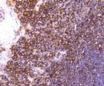 CD44 Antibody in Immunohistochemistry (Paraffin) (IHC (P))