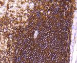 CD44 Antibody in Immunohistochemistry (Paraffin) (IHC (P))