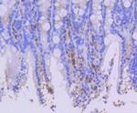 CD44 Antibody in Immunohistochemistry (Paraffin) (IHC (P))