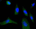 Phospho-eIF4E (Ser209) Recombinant Rabbit Monoclonal Antibody (SU0396)