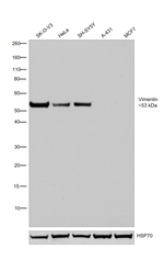 Vimentin Antibody