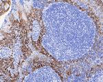 Cytokeratin 5 Antibody in Immunohistochemistry (Paraffin) (IHC (P))