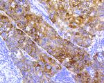 Cytokeratin 5 Antibody in Immunohistochemistry (Paraffin) (IHC (P))