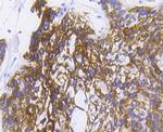 Cytokeratin 5 Recombinant Rabbit Monoclonal Antibody (SC62-04)