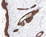 Cytokeratin 5 Antibody in Immunohistochemistry (Paraffin) (IHC (P))