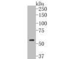 Cytokeratin 5 Antibody in Western Blot (WB)