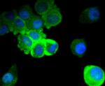 Phospho-Tau (Ser396) Antibody in Immunocytochemistry (ICC/IF)