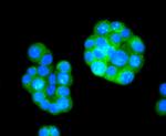 Phospho-Tau (Ser396) Antibody in Immunocytochemistry (ICC/IF)