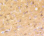Phospho-Tau (Ser396) Antibody in Immunohistochemistry (Paraffin) (IHC (P))