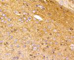 Phospho-Tau (Ser396) Antibody in Immunohistochemistry (Paraffin) (IHC (P))