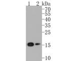 eIF5A Antibody in Western Blot (WB)