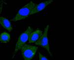 ILK Recombinant Rabbit Monoclonal Antibody (SC68-04)