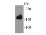 Protein APC Recombinant Rabbit Monoclonal Antibody (SC61-03)