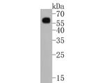 Phospho-SMAD3 (Ser423, Ser425) Antibody in Western Blot (WB)