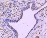 Phospho-HSP27 (Ser78) Antibody in Immunohistochemistry (Paraffin) (IHC (P))