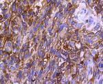 CCR2 Recombinant Rabbit Monoclonal Antibody (SN707)