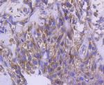IRF5 Recombinant Rabbit Monoclonal Antibody (SN201-05)