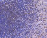 IRF5 Recombinant Rabbit Monoclonal Antibody (SD203-07)