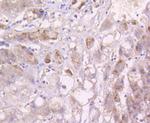 MEK3 Antibody in Immunohistochemistry (Paraffin) (IHC (P))