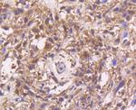 MEK3 Antibody in Immunohistochemistry (Paraffin) (IHC (P))