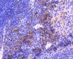 MEK3 Antibody in Immunohistochemistry (Paraffin) (IHC (P))