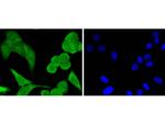 STAT1 Recombinant Rabbit Monoclonal Antibody (SD20-75)