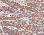 SMAD1 Antibody in Immunohistochemistry (Paraffin) (IHC (P))