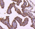 TRAF2 Recombinant Rabbit Monoclonal Antibody (SD205-06)