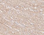 AMPK beta-1 Antibody in Immunohistochemistry (Paraffin) (IHC (P))
