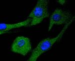 MEK2 Recombinant Rabbit Monoclonal Antibody (SD207-08)