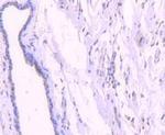 Phospho-AKT1 (Thr450) Antibody in Immunohistochemistry (Paraffin) (IHC (P))