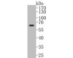 Phospho-AKT1 (Thr450) Antibody in Western Blot (WB)