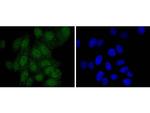 PAX5 Recombinant Rabbit Monoclonal Antibody (JJ08-87)