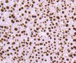 Histone H3 Antibody in Immunohistochemistry (Paraffin) (IHC (P))
