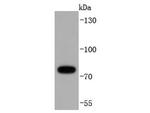 RIP1 Recombinant Rabbit Monoclonal Antibody (JJ092-04)