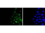 Histone H3 Recombinant Rabbit Monoclonal Antibody (JJ092-08)
