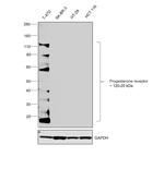 Progesterone Receptor Antibody in Western Blot (WB)